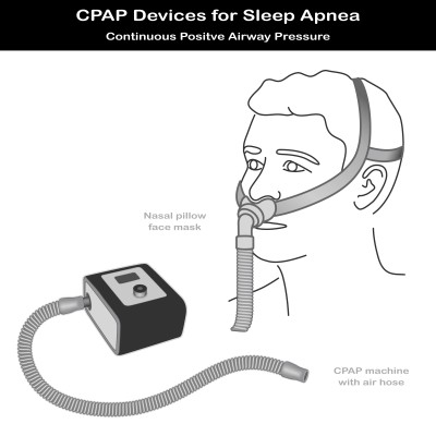 מכשיר CPAP לטיפול בדום נשימה חסימתי בשינה