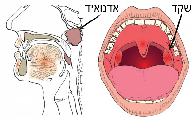 שקדים ואדנואיד